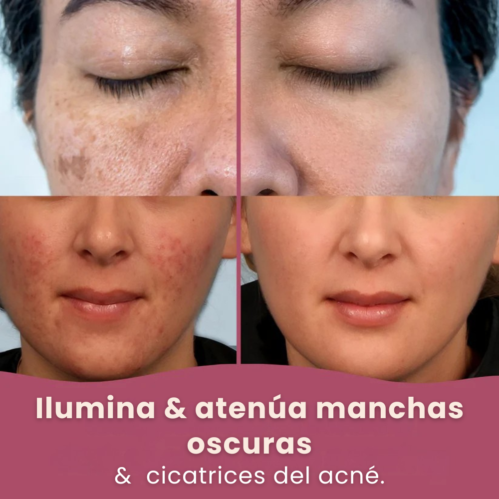 Almohadillas aclaradoras de cúrcuma y ácido kójico